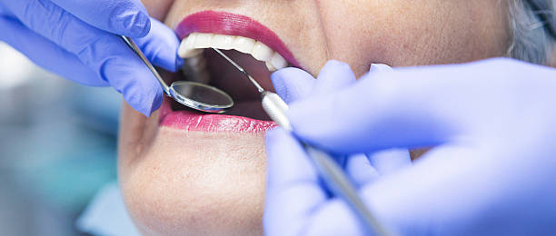 Best Emergency Dental Care for Broken or Chipped Teeth in Mcpherson, KS