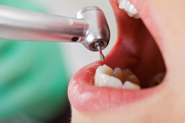 Best Emergency Denture Repair in Mcpherson, KS
